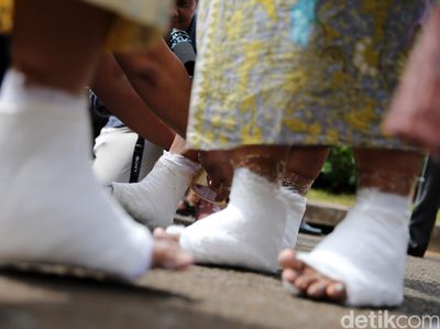 Aksi Membeton Kaki di Depan Istana