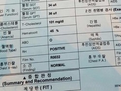 Baru Injakkan Kaki di Bandara Korsel, WNI Dideportasi karena Sakit TBC