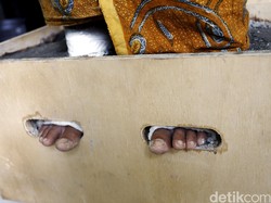 Temui Pendemo yang Kakinya Dicor Semen, Teten: Saya Akan Lapor Presiden