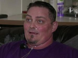 Ke Dokter Berniat Cabut 4 Gigi, Pria Ini Malah Kehilangan Semua Giginya