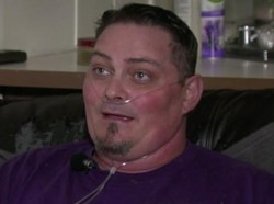 Ke Dokter Berniat Cabut 4 Gigi, Pria Ini Malah Kehilangan Semua Giginya