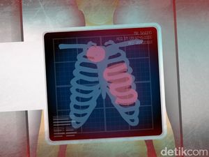 Sidang Etik Kasus Siyono Masuki Tahap Putusan