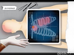 Terancam Dipecat, 2 Anggota Densus Pengawal Siyono Ajukan Pembelaan