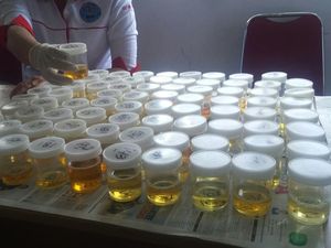 Tes Urine Jadi Metode Baru Diagnosis Infeksi Virus Zika