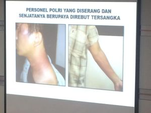 Kapolri Tunjukkan Foto Luka-luka Anggota Densus 88 yang Kawal Siyono