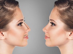 Hidung Palsu Ini Banyak Dipakai Selebgram untuk Terlihat Mancung
