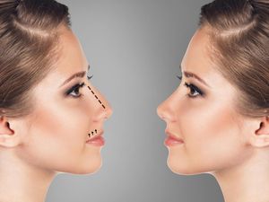 Hidung Palsu Ini Banyak Dipakai Selebgram untuk Terlihat Mancung Hidung Palsu Ini Banyak Dipakai Selebgram untuk Terlihat Mancung