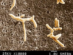 Afrika Selatan Hadapi Wabah Listeria Terburuk Sepanjang Sejarah