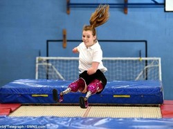 Hebat! Meski Tak Punya Lengan dan Kaki, Remaja Ini Juara Trampolin Nasional