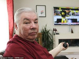 Alergi Listrik, Kulit Kakek Ini Jadi Merah Saat Menonton Televisi