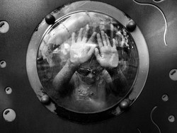 Punya Kondisi Super Langka, Alex Harus Hidup dalam Bayang-bayang