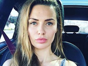 Facial Contouring, Prosedur untuk Wajah Tirus Permanen Tanpa Makeup