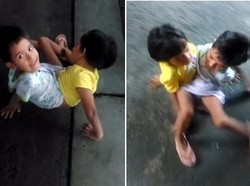 Meski Tubuhnya Menyatu, Kembar Siam Ini Tetap Ceria dan Tak Mau Dipisahkan