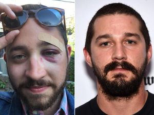 Apes! Gara-gara Mirip Shia LaBeouf, Pria Ini Dipukuli Orang