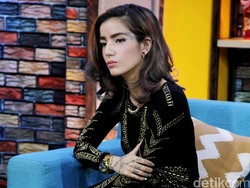 Kecelakaan Mobil, Hidung Sheila Marcia Retak dan Harus Dioperasi