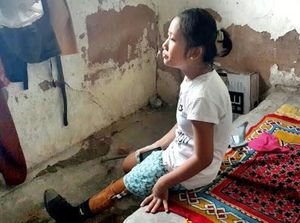 Kisah Ayu Remaja dengan Puisi Jangan Panggil Aku Pincang