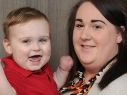 Kisah Taylor, Harus Kehilangan Kaki Kiri dan Seluruh Jari Karena Meningitis