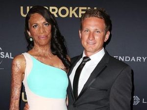 Pulih dari Luka Bakar, Mantan Atlet Ini Berhasil Selesaikan Triatlon