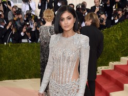 Gaun Metalik Kylie Jenner di Met Gala Buat Kakinya Luka dan Lebam