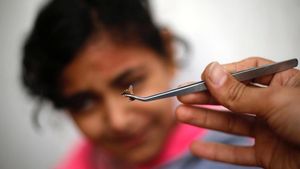 Foto-foto Pengobatan Alternatif Terapi Lebah di Gaza