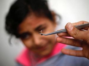 Foto-foto Pengobatan Alternatif Terapi Lebah di Gaza