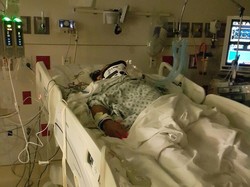 Ilham Ronas WNI Korban Kecelakaan Maut di AS Kritis, Begini Penampakannya