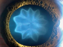 Tumbuh Bunga di Mata Usai Kecelakaan Sepeda, Dicek Ternyata Katarak