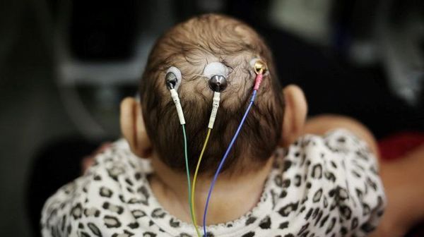 Lucas dan Laura, Bayi Kembar Unik di Brazil yang Jadi Kunci Kalahkan Zika