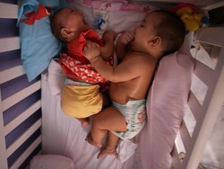 Bayi Kembar Unik di Brazil Ini Bisa Jadi Kunci Kalahkan Zika