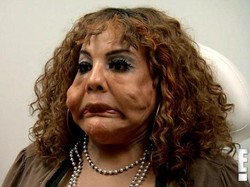 Dokter Kulit Bantu Perbaiki Wajah Wanita yang Berantakan Karena Suntik Semen