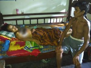 Paini Hanya Terbaring Lemah Digerogoti Kanker Payudara