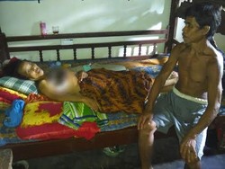 Paini Hanya Terbaring Lemah Digerogoti Kanker Payudara