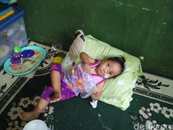 Perjuangan Siti Maemunah Jual Celengan Demi Anaknya yang Alami Cacat Lahir