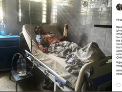 Alat Medis dan Obat Minim, Kisah Sedih RS di Venezuela