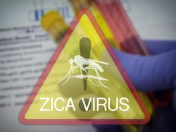 Kasus Mikrosefali Akibat Zika Ditemukan di Haiti dan Guatemala