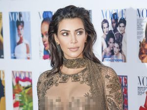 Ikuti Michael Phelps, Kim Kardashian Juga Lakukan Terapi Bekam