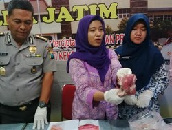 Begini Cara Membedakan Daging Sapi dan Babi