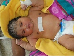 Perempuan India Melahirkan Bayi Seberat Hampir 7 Kg