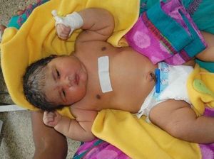 Seorang Ibu Lahirkan Bayi Terberat di India dengan Bobot Mencapai 6,8 Kg