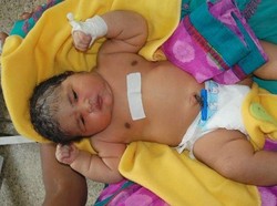 Seorang Ibu Lahirkan Bayi Terberat di India dengan Bobot Mencapai 6,8 Kg