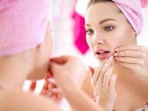 Daftar Makanan Penyebab Jerawat Menurut dr. Richard Lee