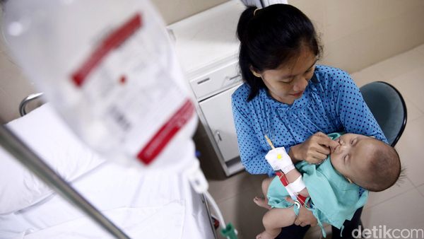 Operasi Bibir Sumbing untuk Kembalikan Senyum Anak Indonesia