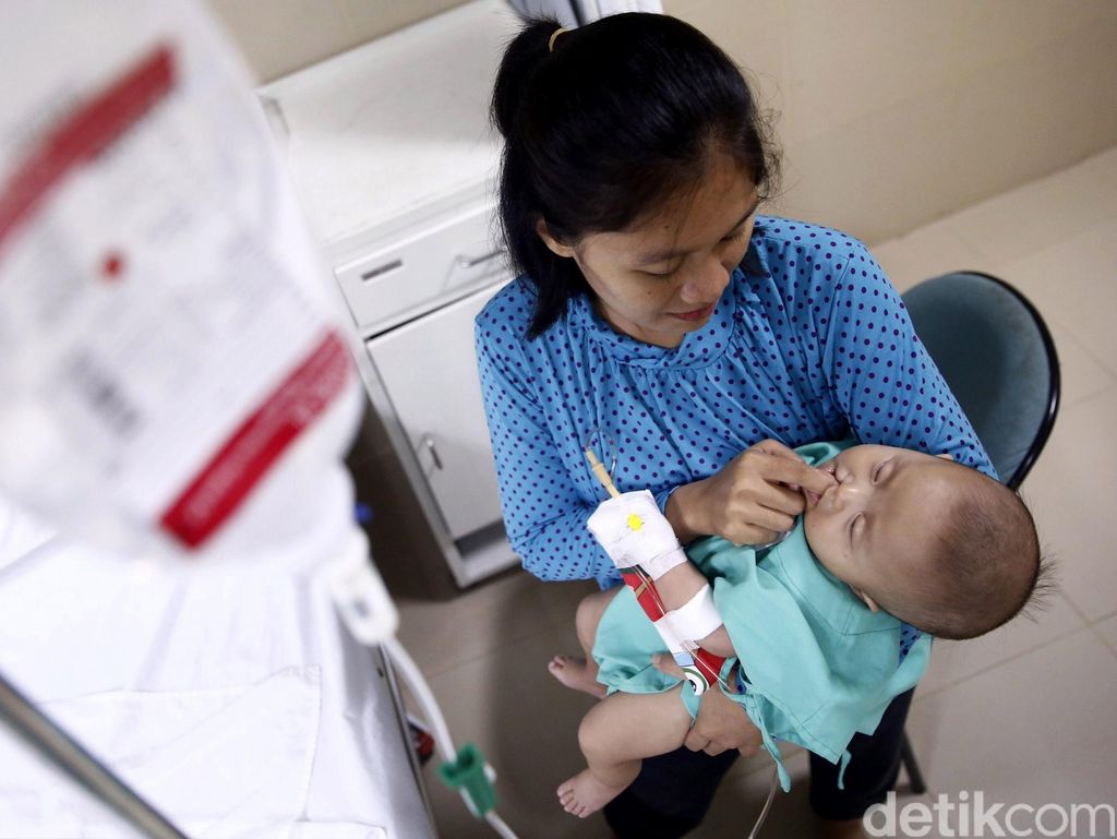 Berbagai Penyebab Bibir Sumbing, Dari Obat Sembarangan Hingga Kurang Nutrisi Berbagai Penyebab Bibir Sumbing, Dari Obat Sembarangan Hingga Kurang Nutrisi