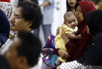 Bunda, Ketahui Penyebab dan Risiko Bibir Sumbing pada Bayi