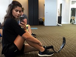 Kisah Jess, Sukses Jadi Model Meski Kehilangan Kaki Kanan karena Kanker Tulang