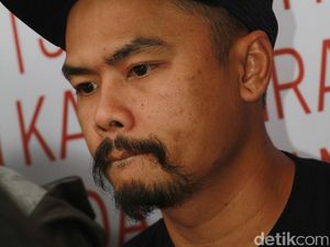 Wendy Cagur Ternyata Sudah Bolak-balik Rumah Sakit