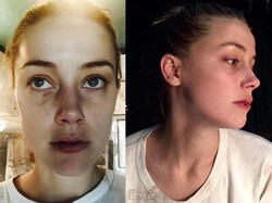 Saat Suami Suka Melakukan Kekerasan, Kenapa Ada Istri yang Memilih Bertahan?