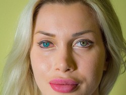 Model Ini Habiskan Rp 1,6 Miliar untuk Operasi Plastik Termasuk Implan Mata