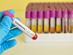 Jangan Khawatir, dengan Perawatan Tepat Toksoplasma Bisa Disembuhkan Kok