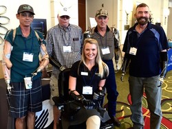 Meski Tubuh Sempat Digerogoti Bakteri Pemakan Daging, Aimee Tetap Semangat